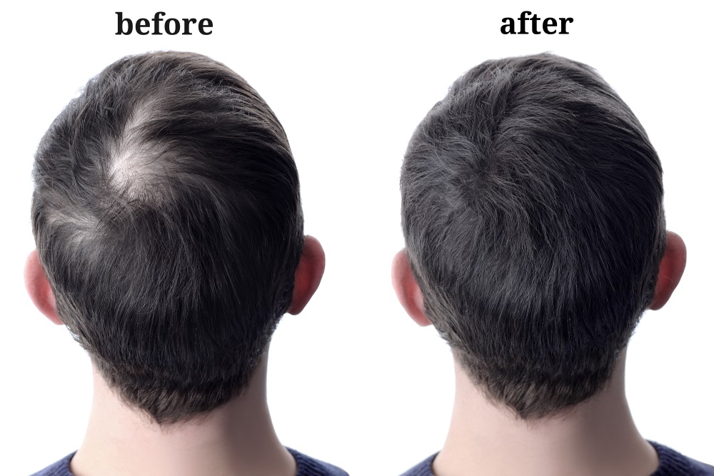 Hair Thickening Spray